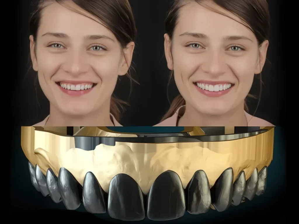 3D-моделирование улыбки