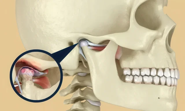 Гнатология для подростков: особенности лечения в период роста