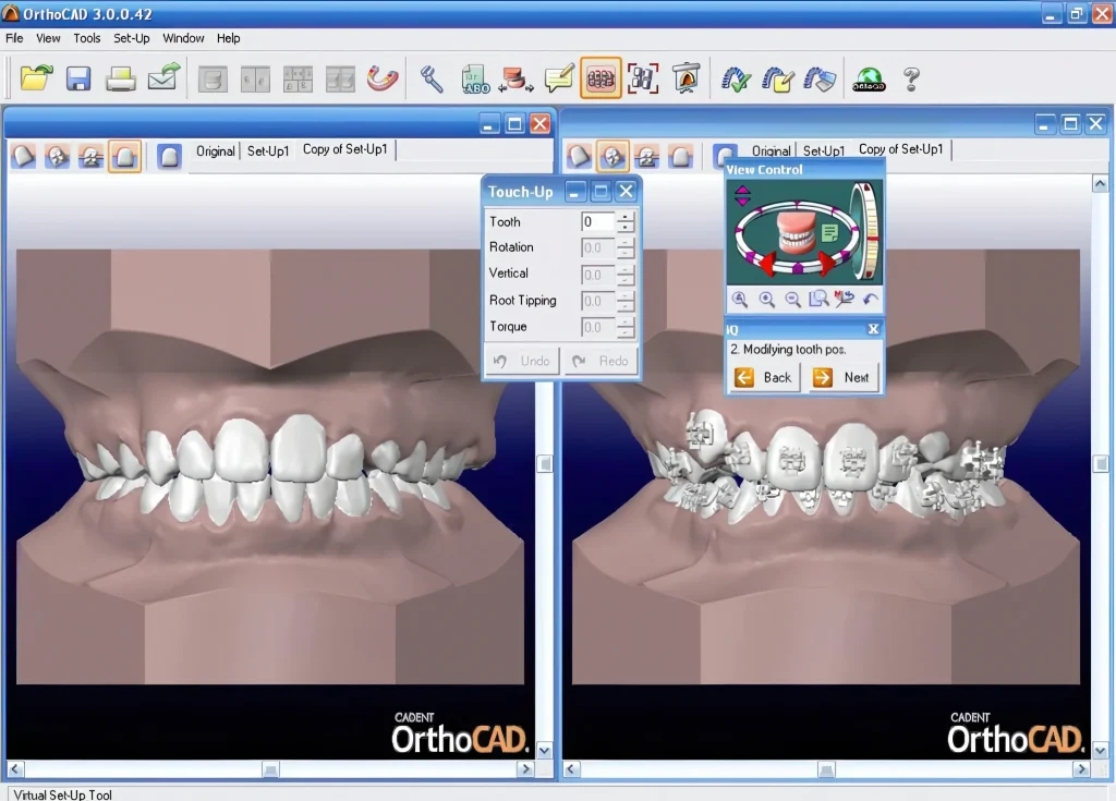 окно программы OrthoCAD для 3D-моделирования зубных рядов