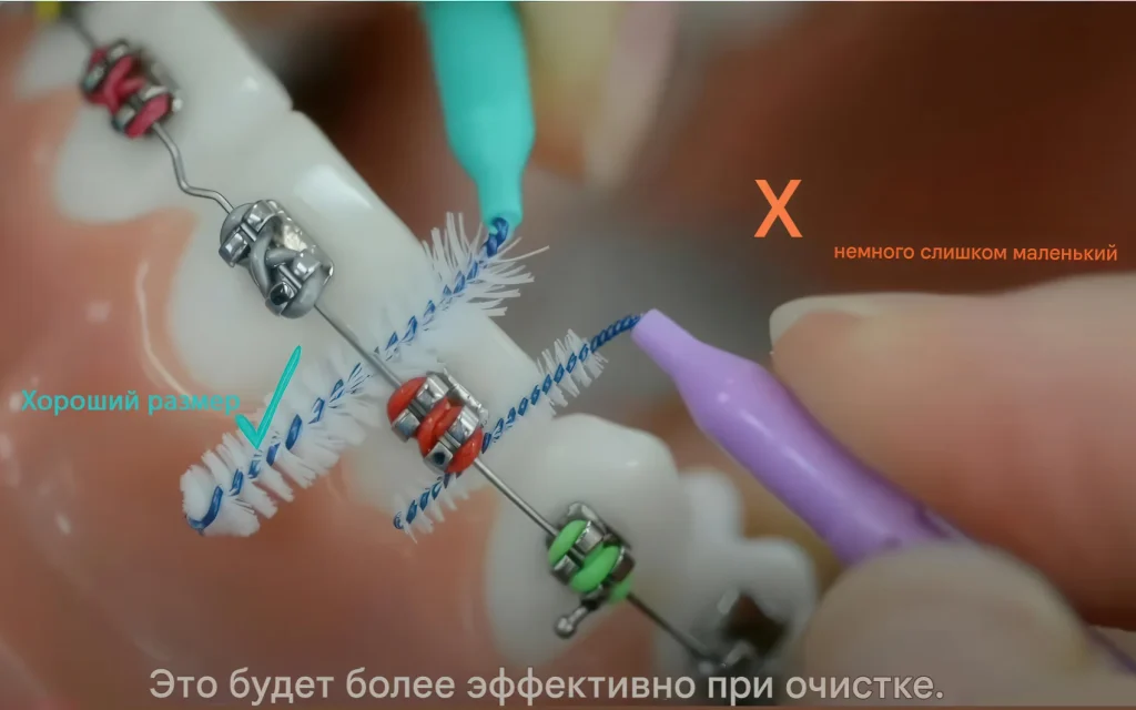 пример размеров ершиков