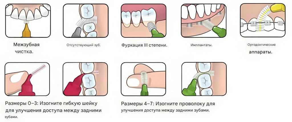 назначение ершиков