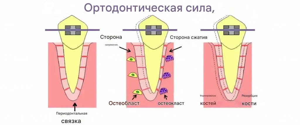 Ремоделирование костной ткани